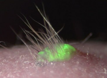 Promising Lab-Grown Skin Sprouts Hair and Grows Glands
